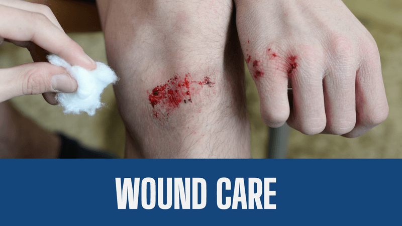 Comprehensive Guide to Wound Care Types,
